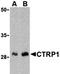 C1q And TNF Related 1 antibody, orb74632, Biorbyt, Western Blot image 