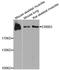 Erb-B2 Receptor Tyrosine Kinase 3 antibody, A0950, ABclonal Technology, Western Blot image 