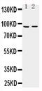 ADAM Metallopeptidase With Thrombospondin Type 1 Motif 4 antibody, PA1479, Boster Biological Technology, Western Blot image 