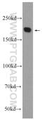 Nucleoporin 205 antibody, 24439-1-AP, Proteintech Group, Western Blot image 