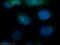 Proteasome Subunit Alpha 2 antibody, 14377-1-AP, Proteintech Group, Immunofluorescence image 