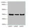 Zinc Finger Protein 625 antibody, orb357779, Biorbyt, Western Blot image 
