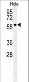 Polypeptide N-Acetylgalactosaminyltransferase 4 antibody, LS-C166356, Lifespan Biosciences, Western Blot image 