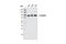 Catenin Beta 1 antibody, 9582T, Cell Signaling Technology, Western Blot image 