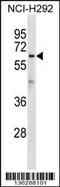 Atlastin-1 antibody, MBS9202748, MyBioSource, Western Blot image 