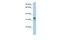 Glycine-N-Acyltransferase Like 2 antibody, PA5-43275, Invitrogen Antibodies, Western Blot image 