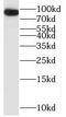 Oligophrenin 1 antibody, FNab05988, FineTest, Western Blot image 