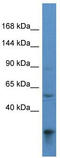 Acyl-CoA Dehydrogenase Family Member 10 antibody, TA343056, Origene, Western Blot image 