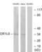 Olfactory Receptor Family 1 Subfamily L Member 6 antibody, abx015407, Abbexa, Western Blot image 