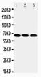 Interleukin 1 Receptor Associated Kinase 3 antibody, PA2207-1, Boster Biological Technology, Western Blot image 