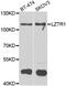 Leucine Zipper Like Transcription Regulator 1 antibody, abx006924, Abbexa, Western Blot image 