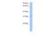 Potassium Channel Tetramerization Domain Containing 21 antibody, A18105, Boster Biological Technology, Western Blot image 