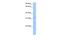 Potassium Channel Tetramerization Domain Containing 21 antibody, A18105, Boster Biological Technology, Western Blot image 