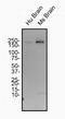 Spectrin Beta, Non-Erythrocytic 4 antibody, NBP2-59668, Novus Biologicals, Western Blot image 