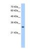 Neural Proliferation, Differentiation And Control 1 antibody, NBP1-62571, Novus Biologicals, Western Blot image 