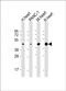 Wnt Family Member 5A antibody, PA5-72454, Invitrogen Antibodies, Western Blot image 