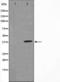 NFKB Inhibitor Alpha antibody, TA325725, Origene, Western Blot image 