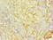 S100 Calcium Binding Protein A8 antibody, MBS1492041, MyBioSource, Immunohistochemistry paraffin image 