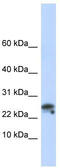 Granulysin antibody, TA346467, Origene, Western Blot image 