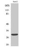 Acyl-CoA Binding Domain Containing 6 antibody, A33955, Boster Biological Technology, Western Blot image 