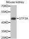 General Transcription Factor IIIA antibody, PA5-76387, Invitrogen Antibodies, Western Blot image 