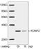 Kv channel-interacting protein 2 antibody, LS-B13699, Lifespan Biosciences, Western Blot image 