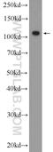 DENN Domain Containing 1A antibody, 25658-1-AP, Proteintech Group, Enzyme Linked Immunosorbent Assay image 