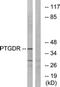 Prostaglandin D2 Receptor antibody, LS-B14167, Lifespan Biosciences, Western Blot image 
