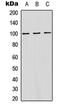 ATPase Na+/K+ Transporting Subunit Alpha 1 antibody, LS-C358418, Lifespan Biosciences, Western Blot image 