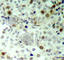 Cyclin Dependent Kinase 2 antibody, AP0325, ABclonal Technology, Immunohistochemistry paraffin image 