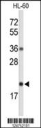 Ribonuclease H2 Subunit C antibody, 63-884, ProSci, Western Blot image 