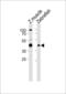 RNA Binding Motif Protein 22 antibody, LS-C162492, Lifespan Biosciences, Western Blot image 