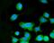 Mitogen-Activated Protein Kinase Kinase 3 antibody, PB9763, Boster Biological Technology, Immunofluorescence image 