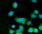 Mitogen-Activated Protein Kinase Kinase 3 antibody, PB9763, Boster Biological Technology, Immunofluorescence image 