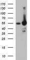 Tyrosine Hydroxylase antibody, TA506542S, Origene, Western Blot image 