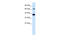 Glutamate Ionotropic Receptor Kainate Type Subunit 2 antibody, 28-304, ProSci, Immunohistochemistry paraffin image 