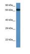 Mbt Domain Containing 1 antibody, NBP1-91375, Novus Biologicals, Western Blot image 