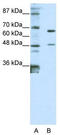 Zinc Finger Protein 597 antibody, TA345545, Origene, Western Blot image 