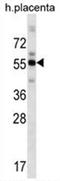 Zinc Finger And BTB Domain Containing 8B antibody, AP54617PU-N, Origene, Western Blot image 
