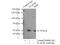 Transcription Factor AP-2 Beta antibody, 13183-1-AP, Proteintech Group, Immunoprecipitation image 