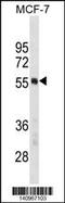 Polypyrimidine Tract Binding Protein 1 antibody, 60-675, ProSci, Western Blot image 