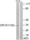 Olfactory Receptor Family 1 Subfamily S Member 2 antibody, abx015408, Abbexa, Western Blot image 