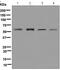 FTO Alpha-Ketoglutarate Dependent Dioxygenase antibody, ab124892, Abcam, Western Blot image 