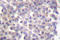 Keratin 18 antibody, LS-C176096, Lifespan Biosciences, Immunohistochemistry paraffin image 