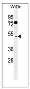 Regulator Of Microtubule Dynamics 1 antibody, AP53679PU-N, Origene, Western Blot image 