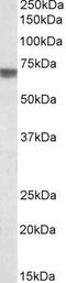 Transforming Growth Factor Beta Induced antibody, GTX88213, GeneTex, Western Blot image 