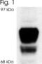 Nuclear Receptor Subfamily 3 Group C Member 1 antibody, PA3-514, Invitrogen Antibodies, Western Blot image 