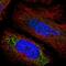 SPINK5 antibody, HPA011351, Atlas Antibodies, Immunofluorescence image 