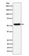 Protein Inhibitor Of Activated STAT 2 antibody, M04130-1, Boster Biological Technology, Western Blot image 