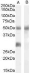 Insulin Like Growth Factor Binding Protein 3 antibody, NBP1-00203, Novus Biologicals, Western Blot image 